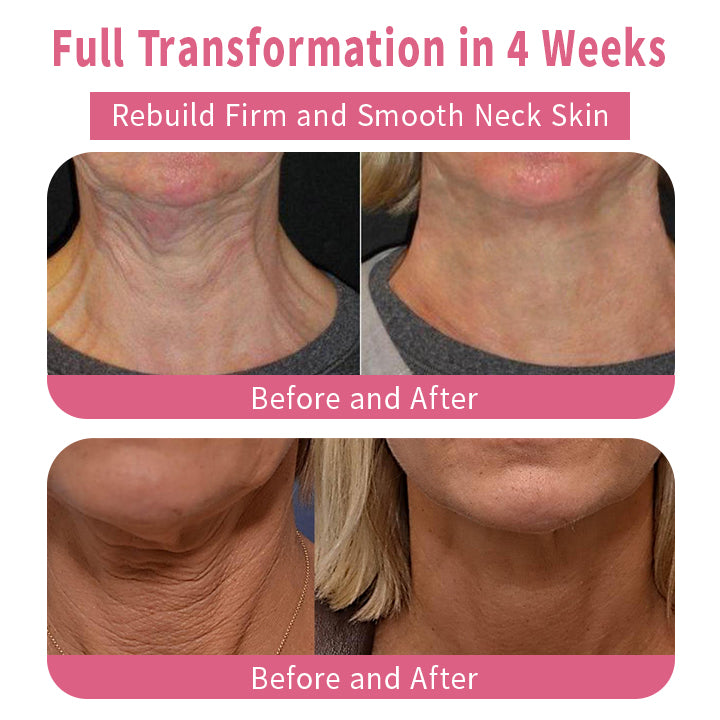 Juxek™ LuximPlus Neck Firming Cream