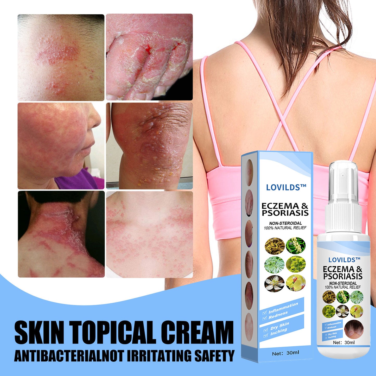 LOVILDS™ Eczema & Psoriasis Relief Spray