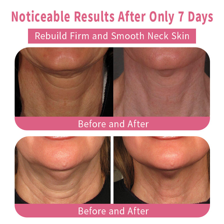 Juxek™ LuximPlus Neck Firming Cream