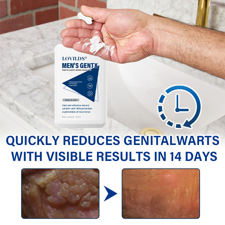 LOVILDS® Men’s GentX Genital Warts Eraser Cream Pro