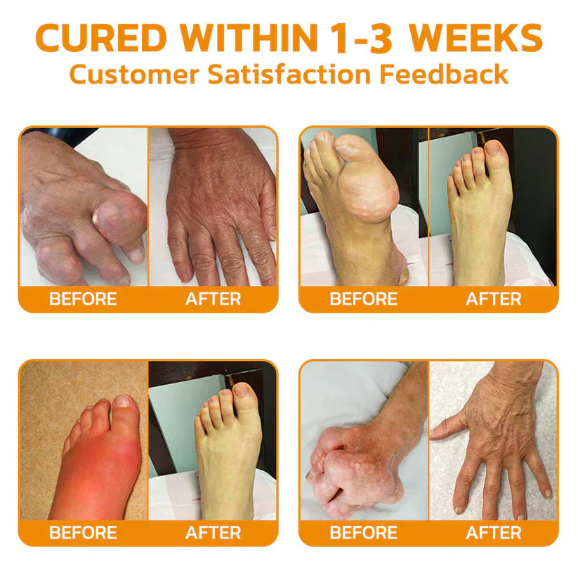 AQA™ Botulinum and Bee Toxin Pain Relief Bone Healing Cream