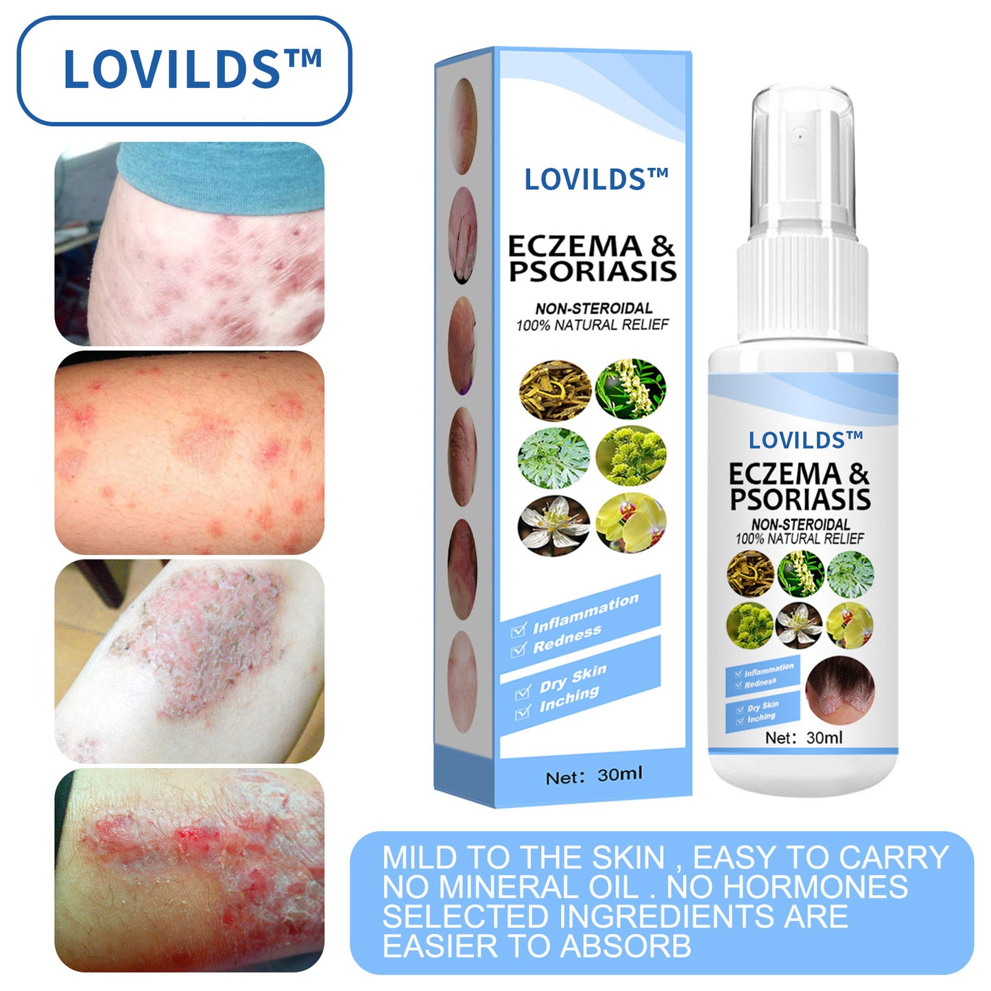 LOVILDS™ Eczema & Psoriasis Relief Spray