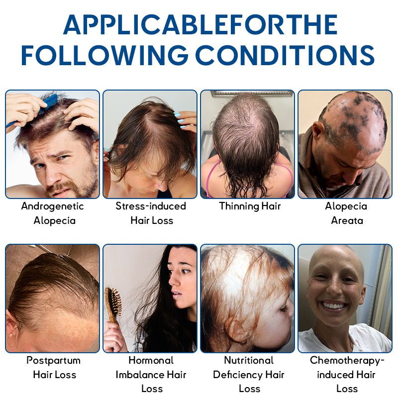 🦘𝐎𝐟𝐟𝐢𝐜𝐢𝐚𝐥 𝐒𝐭𝐨𝐫𝐞 | LOVILDS® STEM Cell Hair Cycle Roller - See results in 7 days (🔥UP TO 70% OFF)