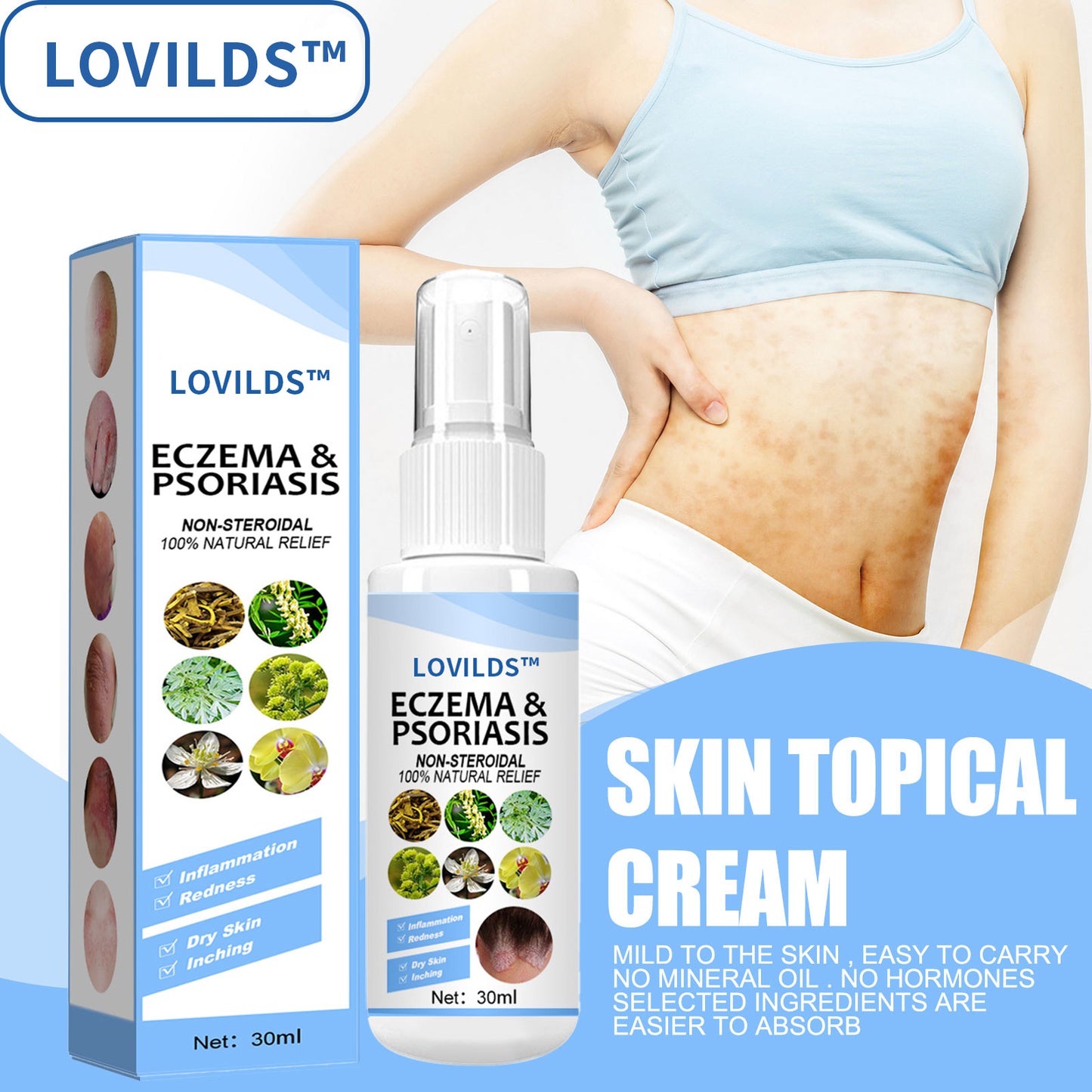 LOVILDS™ Eczema & Psoriasis Relief Spray