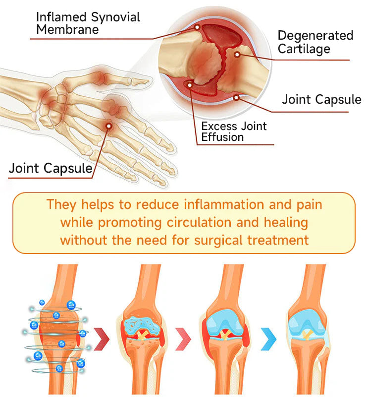 AQA™ Botulinum and Bee Toxin Pain Relief Bone Healing Cream