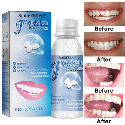 🦷 SmileFitPro™ Dental Filling Gel – Pain-Free, Drill-Free Cavity Solution💖💖