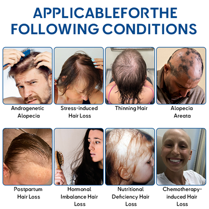 🦘𝐎𝐟𝐟𝐢𝐜𝐢𝐚𝐥 𝐒𝐭𝐨𝐫𝐞 | LOVILDS® STEM Cell Hair Cycle Roller - See results in 7 days (🔥UP TO 70% OFF)